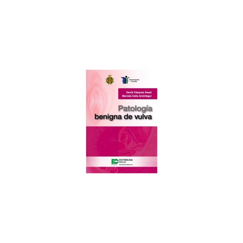 Patología benigna de vulva 9789585577077