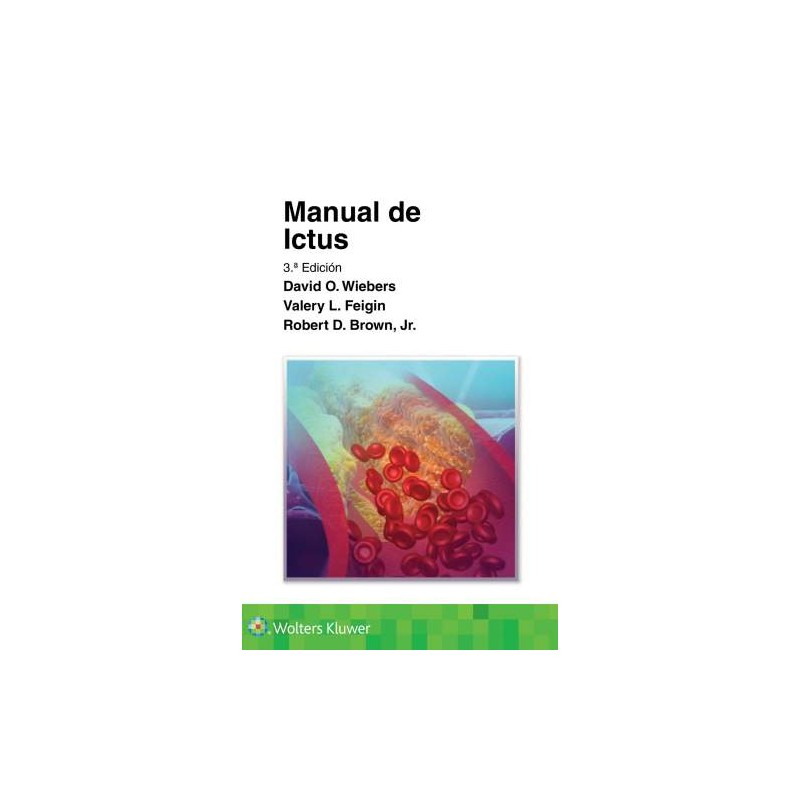 Wiebers: Manual de ictus