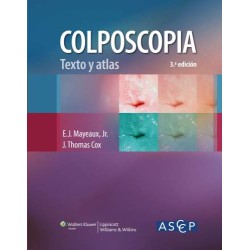 Colposcopia. Texto y atlas 9788415419853