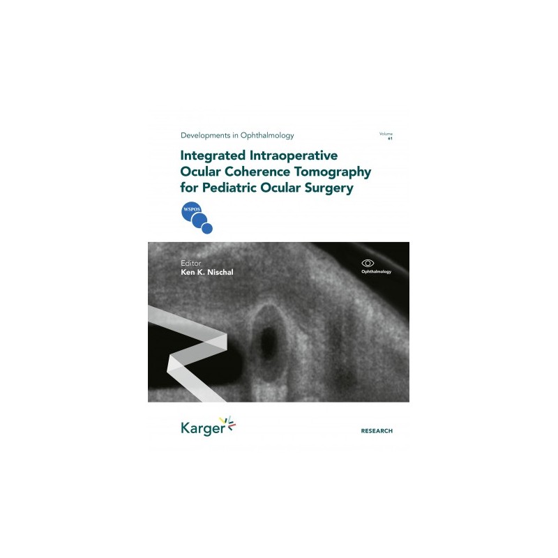 Integrated Intraoperative Ocular Coherence Tomography for Pediatric Ocular Surgery