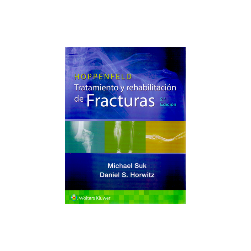 Hoppenfeld. Tratamiento y rehabilitación de fracturas 2 Ed. 9788418563898