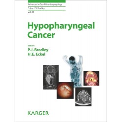 Hypopharyngeal Cancer