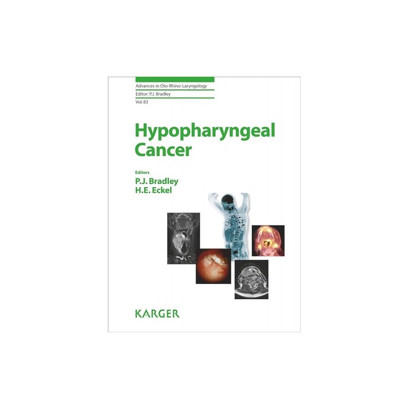 Hypopharyngeal Cancer