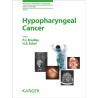 Hypopharyngeal Cancer