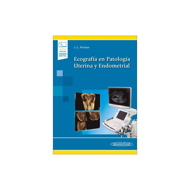 Alcazar: Ecografía en Patología Uterina y Endometrial 9788491106135