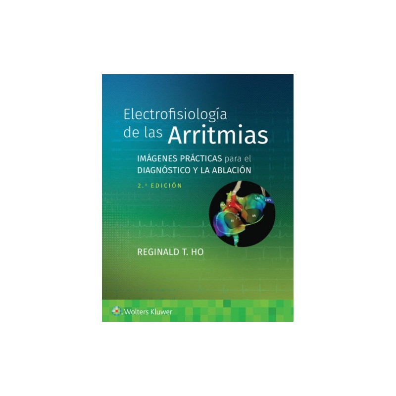 Electrofisiología de las arritmias 9788419663061