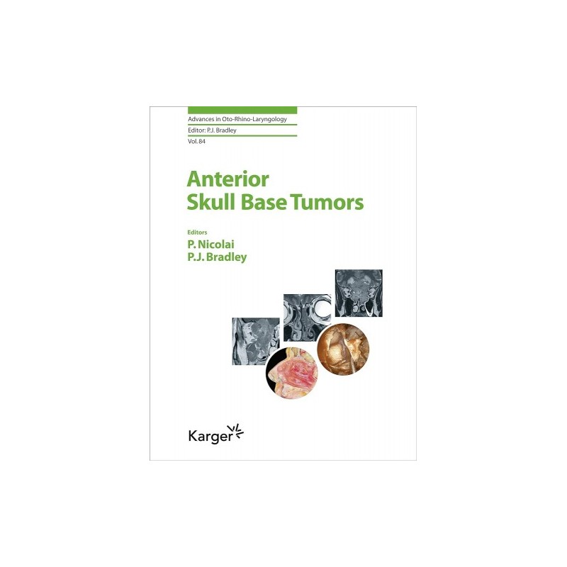 Anterior Skull Base Tumors