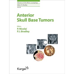 Anterior Skull Base Tumors