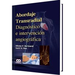 Abordaje Transradial Diagnóstico e Intervención Angiográfica