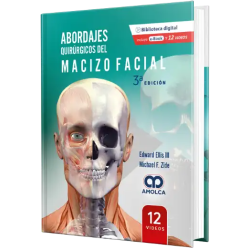 Abordajes Quirúrgicos del Macizo Facial 3a EDICIÓN.