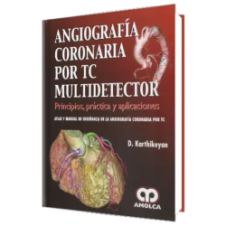 Angiografía Coronaria por TC Multidetector. Principios, Práctica y Aplicaciones