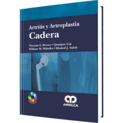 Artritis y Artroplastia Cadera. Incluye DVD