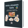 Artritis y Artroplastia Rodilla