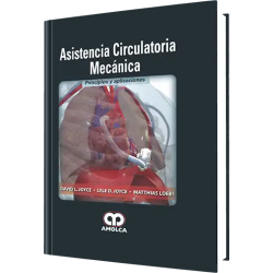 Asistencia Circulatoria Mecánica. Principios y Aplicaciones