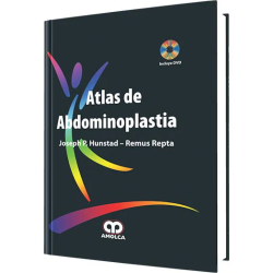 Atlas de Abdominoplastia