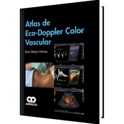 Atlas de Eco-Doppler Color Vascular