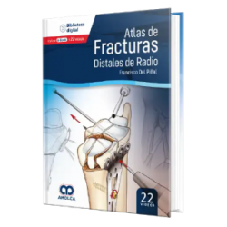 Atlas de Fracturas Distales de Radio.