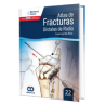 Atlas de Fracturas Distales de Radio.