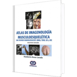 Atlas de Imagenología Musculoesquelética. 200 Signos Radiológicos:RMN, TEM, US y RX. 2da Edición