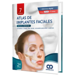 Atlas de Implantes Faciales. Segunda Edición.