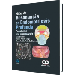 Atlas de Resonancia en Endometriosis Profunda