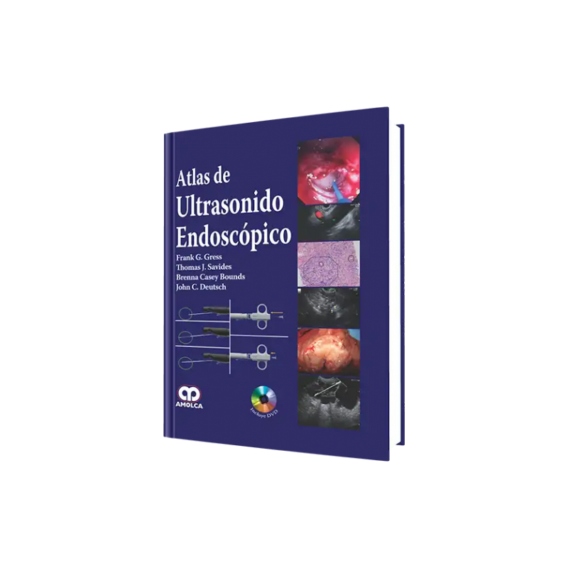 Atlas de Ultrasonido Endoscópico. Incluye DVD