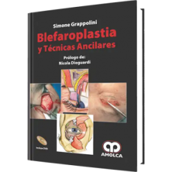 Blefaroplastía y Técnicas Ancilares. Incluye DVD.