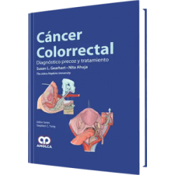 Cáncer Colorrectal