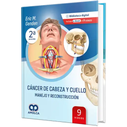 Cáncer de Cabeza y Cuello. Manejo y Reconstrucción. 2da Edición.