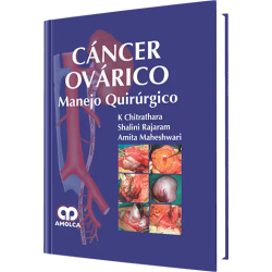 Cáncer Ovárico Manejo Quirúrgico