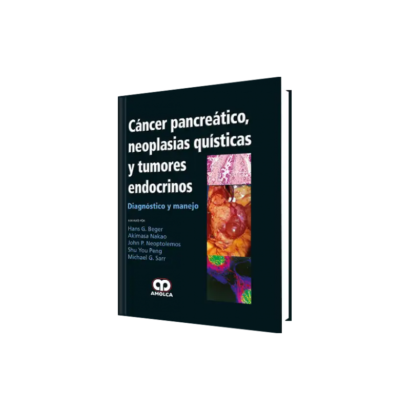 Cáncer Pancreáticos Neoplasias Quísticas y Tumores Endocrinos