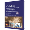 Celulitis Diagnóstico y Terapia del Fibroedema Evolutivo Femenino