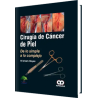 Cirugía de Cáncer de Piel