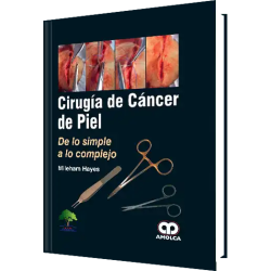 Cirugía de Cáncer de Piel