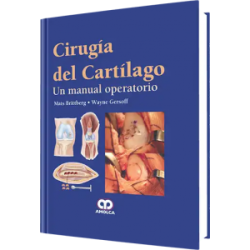 Cirugía del Cartílago.