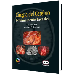 Cirugía del Cerebro Mínimamente Invasiva