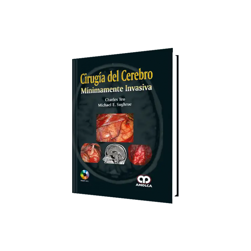 Cirugía del Cerebro Mínimamente Invasiva