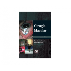 Cirugía Macular