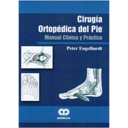 Cirugía Ortopédica del Pie