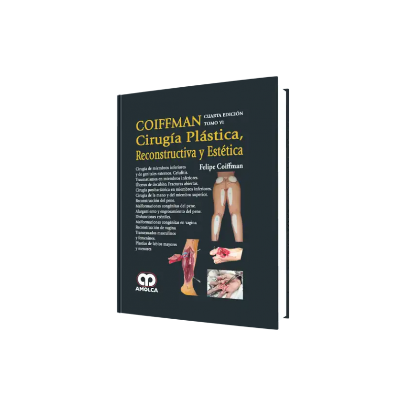 Cirugía Plástica Reconstructiva y Estética. 4ta. Edición Tomo VI. Cirugía de Miembros Inferiores y de Genitales Externos