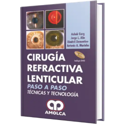 Cirugía Refractiva Lenticular.