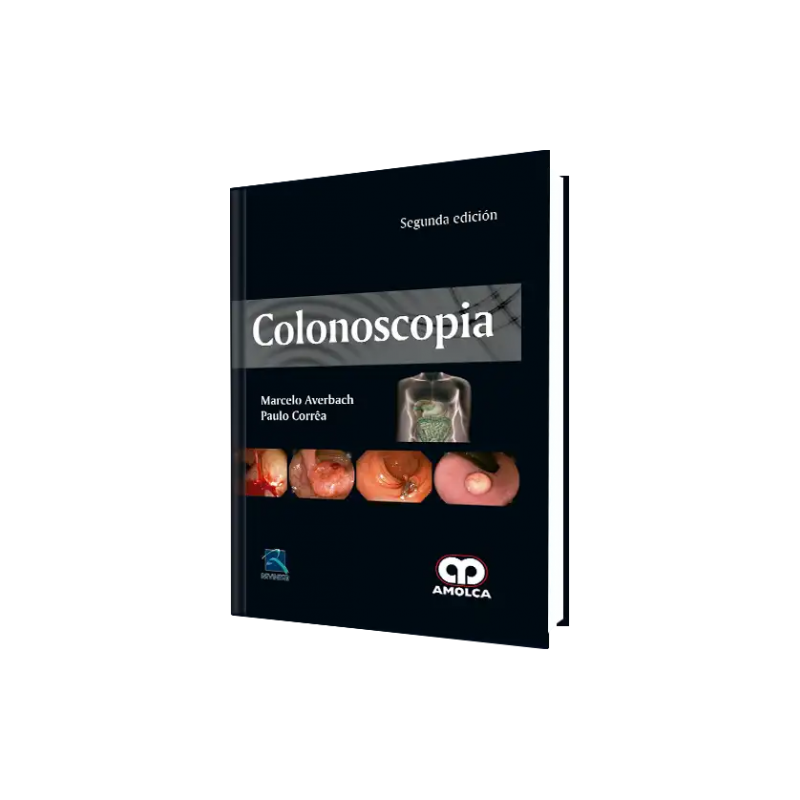 Colonoscopia. Segunda Edición 9789588950136