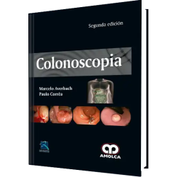 Colonoscopia. Segunda Edición 9789588950136