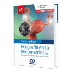 Como realizar una Ecografía en la Endometriosis.