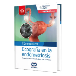 Como realizar una Ecografía en la Endometriosis.