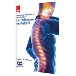 Diagnóstico Diferencial en Neuroimagen. La Columna Vertebral