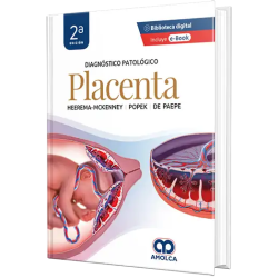 Diagnóstico Patológico. Placenta. 2da Edición