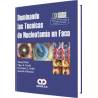 Dominando las Técnicas de Nucleotomía en FACO.