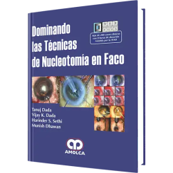 Dominando las Técnicas de Nucleotomía en FACO.