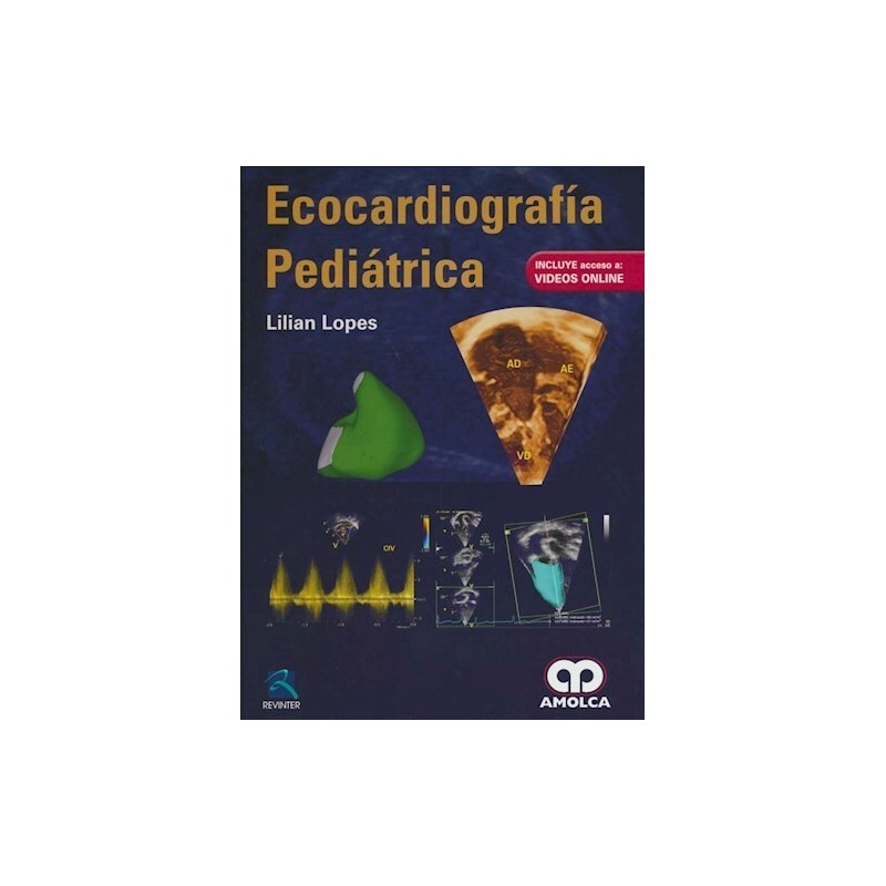 Ecocardiografía Pediátrica